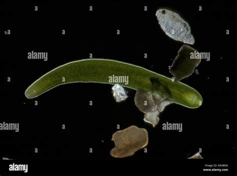  Convoluta!  A Tiny Flatworm That Swims Through Sand Grains Like It's Surfing the Ocean Floor