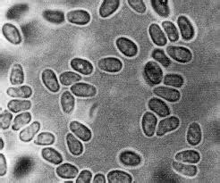  Microsporidium: ผู้สิงสถิตในเซลล์ตัวน้อยที่ชวนตะลึง!